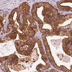 Merck Anti-IQGAP2 antibody produced in rabbit