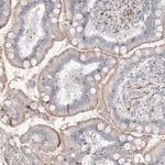 Merck Anti-SH3BP4 antibody produced in rabbit
