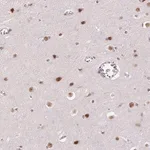 Merck Anti-HNRNPDL antibody produced in rabbit