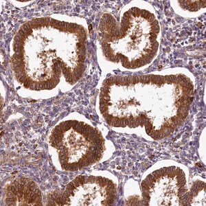 Merck Anti-PPIP5K2 antibody produced in rabbit