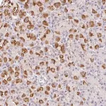 Merck Anti-L3MBTL4 antibody produced in rabbit
