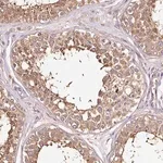 Merck Anti-METAP1 antibody produced in rabbit
