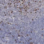Merck Anti-ANKRD16 antibody produced in rabbit