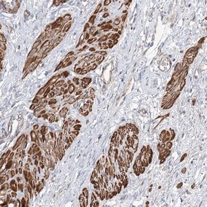 Merck Anti-WASHC3 antibody produced in rabbit