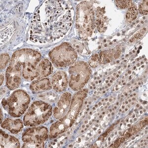 Merck Anti-ADK antibody produced in rabbit