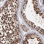 Merck Anti-C12orf10 antibody produced in rabbit