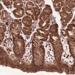 Merck Anti-ANKRD10 antibody produced in rabbit