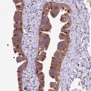 Merck Anti-DYNC2H1 antibody produced in rabbit