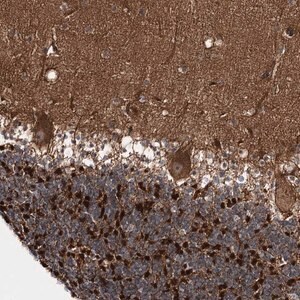 Merck Anti-C11orf80 antibody produced in rabbit