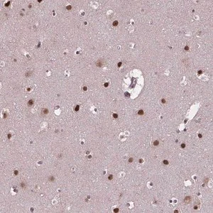 Merck Anti-APTX antibody produced in rabbit