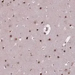 Merck Anti-APTX antibody produced in rabbit