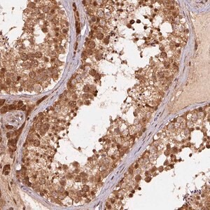 Merck Anti-TREML4 antibody produced in rabbit
