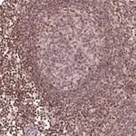 Merck Anti-DDX11 antibody produced in rabbit