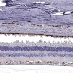 Merck Anti-CLIC6 antibody produced in rabbit