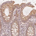 Merck Anti-KLHL15 antibody produced in rabbit