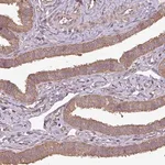 Merck Anti-PLEKHM1 antibody produced in rabbit