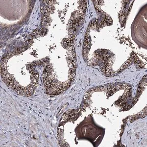 Merck Anti-MICALCL antibody produced in rabbit