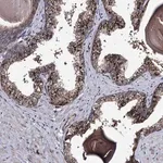 Merck Anti-MICALCL antibody produced in rabbit