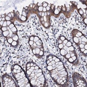 Merck Anti-GPR176 antibody produced in rabbit