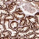 Merck Anti-ARHGAP22 antibody produced in rabbit