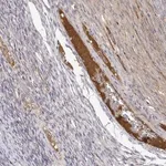 Merck Anti-IGFBP4 antibody produced in rabbit