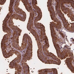 Merck Anti-EIF3D antibody produced in rabbit