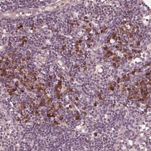 Merck Anti-CXCL16 antibody produced in rabbit