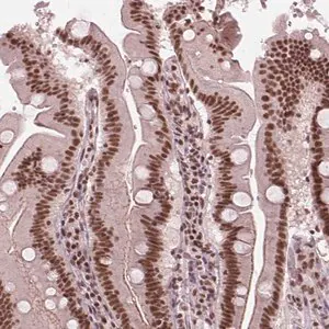 Merck Anti-LSM2 antibody produced in rabbit