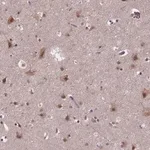 Merck Anti-FAM181B antibody produced in rabbit