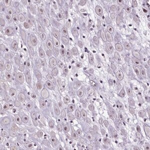 Merck Anti-ATMIN antibody produced in rabbit