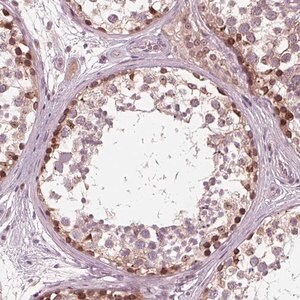 Merck Anti-NUP210 antibody produced in rabbit