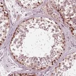 Merck Anti-NUP210 antibody produced in rabbit