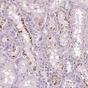 Merck Anti-SAMD5 antibody produced in rabbit