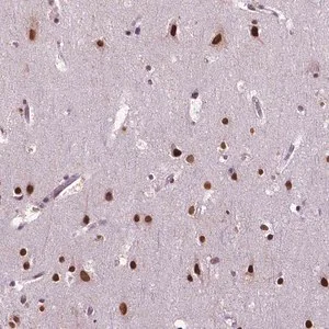 Merck Anti-COL23A1 antibody produced in rabbit