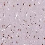 Merck Anti-COL23A1 antibody produced in rabbit