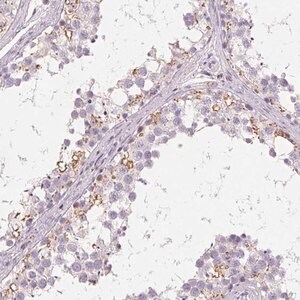 Merck Anti-C19orf84 antibody produced in rabbit