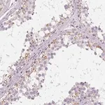 Merck Anti-C19orf84 antibody produced in rabbit