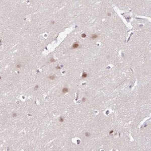 Merck Anti-ACTR3 antibody produced in rabbit