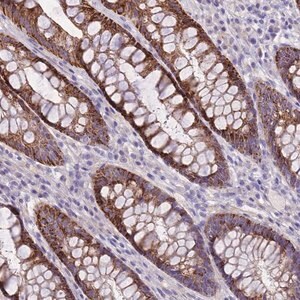 Merck Anti-RIPPLY2 antibody produced in rabbit