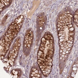 Merck Anti-LEFTY1 antibody produced in rabbit
