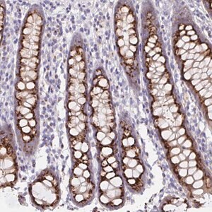 Merck Anti-PRR36 antibody produced in rabbit