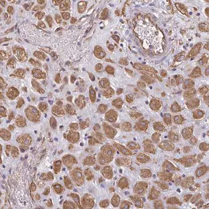 Merck Anti-TRPV6 antibody produced in rabbit