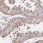 Merck Anti-PGAP2 antibody produced in rabbit