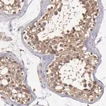 Merck Anti-TTLL12 antibody produced in rabbit
