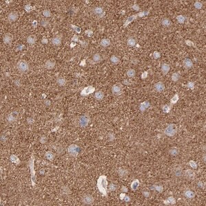Merck Anti-CPE antibody produced in rabbit