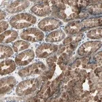 Merck Anti-ETNK1 antibody produced in rabbit