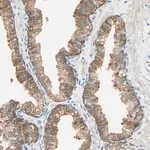 Merck Anti-ATF6 antibody produced in rabbit