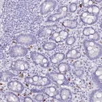 Merck Anti-MYADML2 antibody produced in rabbit