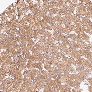 Merck Anti-SERPING1 antibody produced in rabbit