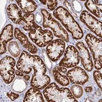 Merck Anti-SETBP1 antibody produced in rabbit